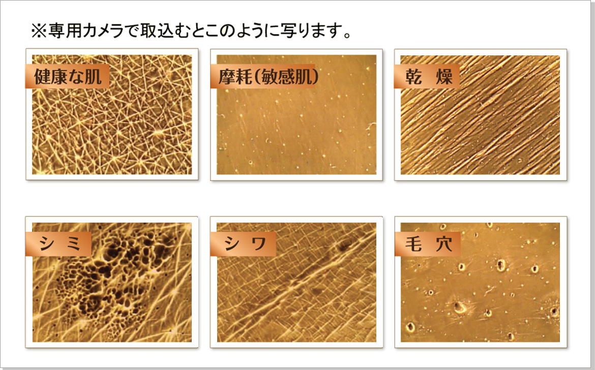 32℃の肌分析はここが違う！